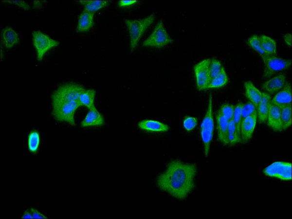 Immunofluorescence staining of MCF-7 cell with CSB-RA960273A0HU at 1:50, counter-stained with DAPI. The cells were fixed in 4% formaldehyde, permeabilized using 0.2% Triton X-100 and blocked in 10% normal Goat Serum. The cells were then incubated with the antibody overnight at 4°C. The secondary antibody was Alexa Fluor 488-congugated AffiniPure Goat Anti-Rabbit IgG(H+L) .
