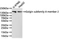 Western Blot
Positive WB detected in: U-87MG whole cell lysate(30µg) , HepG2 whole cell lysate(30µg) 
All lanes: Golgin subfamily A member 2 antibody at 1:1000
Secondary
Goat polyclonal to rabbit IgG at 1/40000 dilution
Predicted band size: 113 kDa
Observed band size: 140 kDa
Exposure time：3min