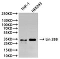 Western Blot, 
Positive WB detected in:THP-1 whole cell lysate(30µg), HEK293 whole cell lysate(30µg)
All lanes: Lin 28B antibody at 1:1000
Secondary
Goat polyclonal to rabbit IgG at 1/40000 dilution
Predicted band size: 27 kDa
Observed band size: 30 kDa
Exposure time：120s