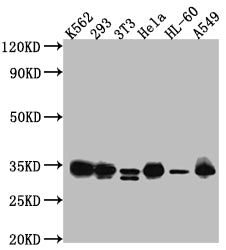 Western Blot
Positive WB detected in: K562 whole cell lysate, HEK293 whole cell lysate, NIH/3T3 whole cell lysate, Hela whole cell lysate, HL-60 whole cell lysate, A549 whole cell lysate
All lanes: CDK2 antibody at 1:1000
Secondary
Goat polyclonal to rabbit IgG at 1/50000 dilution
Predicted band size: 34, 31 kDa
Observed band size: 34 kDa
