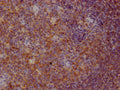 IHC image of CSB-RA962691A0HU diluted at 1:100 and staining in paraffin-embedded human tonsil tissue performed on a Leica BondTM system. After dewaxing and hydration, antigen retrieval was mediated by high pressure in a citrate buffer (pH 6.0) . Section was blocked with 10% normal goat serum 30min at RT. Then primary antibody (1% BSA) was incubated at 4℃ overnight. The primary is detected by a Goat anti-rabbit IgG polymer labeled by HRP and visualized using 0.05% DAB.