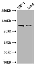 IFIH1 Antibody – Figure 1 of 1