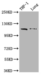 IFIH1 Antibody – Figure 1 of 1