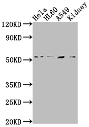 Western Blot
Positive WB detected in: Hela whole cell lysate, HL60 whole cell lysate, A549 whole cell lysate, Mouse kidney tissue
All lanes: ILK antibody at 1:2000
Secondary
Goat polyclonal to rabbit IgG at 1/50000 dilution
Predicted band size: 52, 45, 37 kDa
Observed band size: 51 kDa