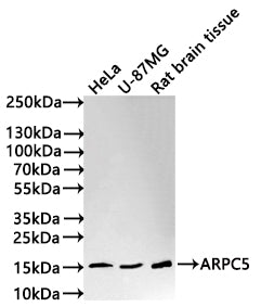 Western Blot
Positive WB detected in: HeLa whole cell lysate(30µg) , U-87MG whole cell lysate(30µg) , Rat brain tissue lysate(30µg) 
All lanes: ARPC5 antibody at 1:1000
Secondary
Goat polyclonal to rabbit IgG at 1/50000 dilution
Predicted band size: 16 kDa
Observed band size: 16 kDa
Exposure time: 5min