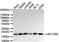 Western Blot
Positive WB detected in: HeLa whole cell lysate(30µg) , HepG2 whole cell lysate(30µg) , COLO205 whole cell lysate(30µg) , A549 whole cell lysate, PC-3 whole cell lysate(30µg) , K562 whole cell lysate(30µg) 
All lanes: MT-CO2 antibody at 1:1000
Secondary
Goat polyclonal to rabbit IgG at 1/50000 dilution
Predicted band size: 26 kDa
Observed band size: 21 kDa
Exposure time: 1min