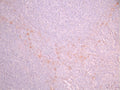 IHC image of CSB-RA964035A0HU diluted at 1:100 and staining in paraffin-embedded human tonsil tissue performed on a Leica BondTM system. After dewaxing and hydration, antigen retrieval was mediated by high pressure in a citrate buffer (pH 6.0). Section was blocked with 10% normal goat serum 30min at RT. Then primary antibody (1% BSA) was incubated at 4°C overnight. The primary is detected by a Goat anti-rabbit polymer IgG labeled by HRP and visualized using 0.05% DAB.