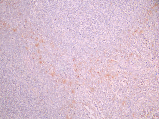 IHC image of CSB-RA964035A0HU diluted at 1:100 and staining in paraffin-embedded human tonsil tissue performed on a Leica BondTM system. After dewaxing and hydration, antigen retrieval was mediated by high pressure in a citrate buffer (pH 6.0). Section was blocked with 10% normal goat serum 30min at RT. Then primary antibody (1% BSA) was incubated at 4°C overnight. The primary is detected by a Goat anti-rabbit polymer IgG labeled by HRP and visualized using 0.05% DAB.