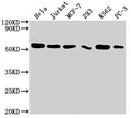 Western Blot
Positive WB detected in: Hela whole cell lysate, Jurkat whole cell lysate, MCF-7 whole cell lysate, 293 whole cell lysate, K562 whole cell lysate, PC-3 whole cell lysate
All lanes: CDC37 antibody at 1:2000
Secondary
Goat polyclonal to rabbit IgG at 1/50000 dilution
Predicted band size: 45 kDa
Observed band size: 50 kDa