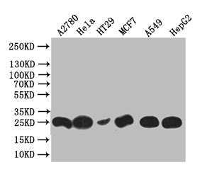 Western Blot
Positive WB detected in: HT29 whole cell lysate, Hela whole cell lysate, HT29 whole cell lysate, MCF7 whole cell lysate, A549 whole cell lysate, HEPG2 whole cell lysate
All lanes: HE4 antibody at 1:1000
Secondary
Goat polyclonal to rabbit IgG at 1/50000 dilution
Predicted band size: 25 kDa
Observed band size: 25 kDa