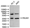 Western Blot, 
Positive WB detected in:PC-3 whole cell lysate(30µg), A431 whole cell lysate(30µg)
All lanes: PDLIM1 antibody at 1:1000
Secondary
Goat polyclonal to rabbit IgG at 1/40000 dilution
Predicted band size: 36 kDa
Observed band size: 36 kDa
Exposure time：120s