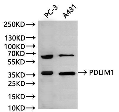 Western Blot, 
Positive WB detected in:PC-3 whole cell lysate(30µg), A431 whole cell lysate(30µg)
All lanes: PDLIM1 antibody at 1:1000
Secondary
Goat polyclonal to rabbit IgG at 1/40000 dilution
Predicted band size: 36 kDa
Observed band size: 36 kDa
Exposure time：120s