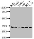 Western Blot
Positive WB detected in: Hela whole cell lysate, HepG2 whole cell lysate, Jurkat whole cell lysate, 293 whole cell lysate, MCF-7 whole cell lysate, PC-3 whole cell lysate
All lanes: CDK4 antibody at 1:2000
Secondary
Goat polyclonal to rabbit IgG at 1/50000 dilution
Predicted band size: 34, 21 kDa
Observed band size: 34 kDa