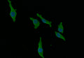 Immunofluorescence staining of MCF-7 with CSB-RA965823A0HU at 1:30, counter-stained with DAPI. The cells were fixed in 4% formaldehyde and blocked in 10% normal Goat Serum. The cells were then incubated with the antibody overnight at 4°C. The secondary antibody was Alexa Fluor 492-congugated AffiniPure Goat Anti-Rabbit IgG(H+L) .