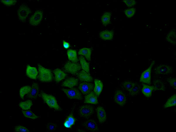 Immunofluorescence staining of Hela cell with CSB-RA965999A0HU at 1:50, counter-stained with DAPI. The cells were fixed in 4% formaldehyde, permeabilized using 0.2% Triton X-100 and blocked in 10% normal Goat Serum. The cells were then incubated with the antibody overnight at 4°C. The secondary antibody was Alexa Fluor 488-congugated AffiniPure Goat Anti-Rabbit IgG(H+L) .