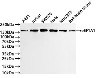 Western Blot
Positive WB detected in:A431 whole cell lysate(30µg) , Jurkat whole cell lysate(30µg) , SW620 whole cell lysate(30µg) , Hela whole cell lysate(30µg) , NIH/3T3 whole cell lysate(30µg) , Rat brain tissue lysate(30µg) 
All lanes: SMC3 antibody at 1:1000
Secondary
Goat polyclonal to rabbit IgG at 1/40000 dilution
Predicted band size: 142 kDa
Observed band size: 142 kDa
Exposure time：40s
