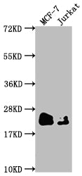 Western Blot
Positive WB detected in: MCF-7 whole cell lysate, Jurkat whole cell lysate
All lanes: MGMT antibody at 1:1500
Secondary
Goat polyclonal to rabbit IgG at 1/50000 dilution
Predicted band size: 22 kDa
Observed band size: 22 kDa