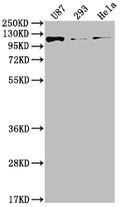 Western Blot
Positive WB detected in: U87 whole cell lysate, 293 whole cell lysate, Hela whole cell lysate
All lanes: FGFR3 antibody at 1:2000
Secondary
Goat polyclonal to rabbit IgG at 1/50000 dilution
Predicted band size: 88, 89, 76, 86 kDa
Observed band size: 115 kDa