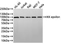 Western Blot
Positive WB detected in: HL-60 whole cell lysate(30µg) , Jurkat whole cell lysate(30µg) , Raji whole cell lysate(30µg) , MCF-7 whole cell lysate(30µg) , Hela whole cell lysate(30µg) , THP-1 whole cell lysate(30µg) 
All lanes: IKK epsilon antibody at 1:1000
Secondary
Goat polyclonal to rabbit IgG at 1/40000 dilution
Predicted band size: 80 kDa
Observed band size: 95 kDa
Exposure time：1min