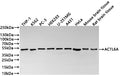Western Blot
Positive WB detected in: THP-1 whole cell lysate(30µg) , K562 whole cell lysate(30µg) , PC-3 whole cell lysate(30µg) , HEK293 whole cell lysate(30µg) , U-251MG whole cell lysate(30µg) , A431 whole cell lysate(30µg) , HeLa whole cell lysate(30µg) , Mouse brain tissue lysate(30µg) , Rat brain tissue lysate(30µg) 
All lanes: ACTL6A antibody at 1:1000
Secondary
Goat polyclonal to rabbit IgG at 1/40000 dilution
Predicted band size: 47 kDa
Observed band size: 47 kDa
Exposure time：30s