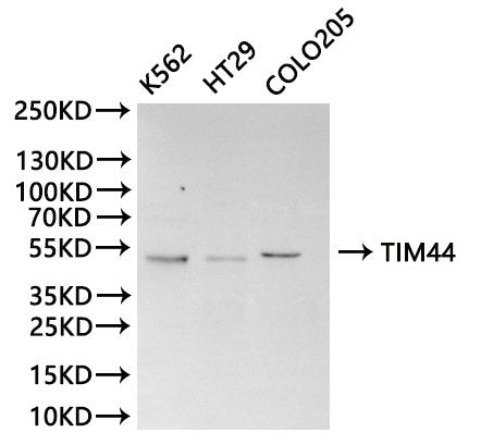 Western Blot
Positive WB detected in: K562 whole cell lysate(30µg), HT-29 whole cell lysate(30µg), COLO-205 whole cell lysate(30µg), Rat liver tissue lysate(30µg)
All lanes: TIM44 antibody at 1:1000
Secondary
Goat polyclonal to rabbit IgG at 1/40000 dilution
Predicted band size: 51 kDa
Observed band size: 51 kDa
Exposure time：20s