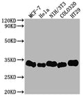 Western Blot
Positive WB detected in: MCF-7 whole cell lysate, Hela whole cell lysate, NIH/3T3 whole cell lysate, Colo320 whole cell lysate, HT29 whole cell lysate
All lanes: Galectin 3 antibody at 1:2000
Secondary
Goat polyclonal to rabbit IgG at 1/50000 dilution
Predicted band size: 27 kDa
Observed band size: 31 kDa