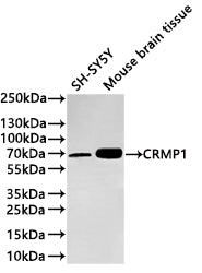 Western Blot
Positive WB detected in: SH-SY5Y whole cell lysate(20µg) ,Mouse brain tissue lysate(20µg) 
All lanes: CRMP1 antibody at 1:1000
Secondary
Goat polyclonal to rabbit IgG at 1/40000 dilution
Predicted band size: 62 kDa
Observed band size: 62 kDa
Exposure time：2min