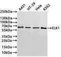 Western Blot
Positive WB detected in: A431 whole cell lysate(30µg) , HT-29 whole cell lysate(30µg) , Hela whole cell lysate(30µg) , K562 whole cell lysate(30µg) 
All lanes: ELK1 antibody at 1:1000
Secondary
Goat polyclonal to rabbit IgG at 1/40000 dilution
Predicted band size: 45 kDa
Observed band size: 62 kDa
Exposure time：3min