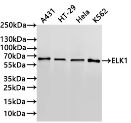 Western Blot
Positive WB detected in: A431 whole cell lysate(30µg) , HT-29 whole cell lysate(30µg) , Hela whole cell lysate(30µg) , K562 whole cell lysate(30µg) 
All lanes: ELK1 antibody at 1:1000
Secondary
Goat polyclonal to rabbit IgG at 1/40000 dilution
Predicted band size: 45 kDa
Observed band size: 62 kDa
Exposure time：3min