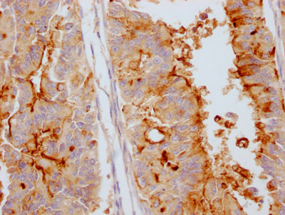 MUC16 Antibody – Figure 1 of 1