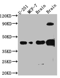 Western Blot
Positive WB detected in: U-251 whole cell lysate, MCF-7 whole cell lysate, Mouse Brain whole cell lysate, Rat Brain whole cell lysate
All lanes: SOX2 antibody at 1:1000
Secondary
Goat polyclonal to rabbit IgG at 1/50000 dilution
Predicted band size: 35 kDa
Observed band size: 40 kDa