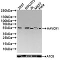 HAVCR1 Antibody – Figure 1 of 1