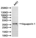 Western Blot
Positive WB detected in: NIH/3T3 whole cell lysate(30µg)
All lanes:Aquaporin 1 antibody at 1:1000
Secondary
Goat polyclonal to rabbit IgG at 1/40000 dilution
Predicted band size: 29 kDa
Observed band size: 40 kDa
Exposure time：2min