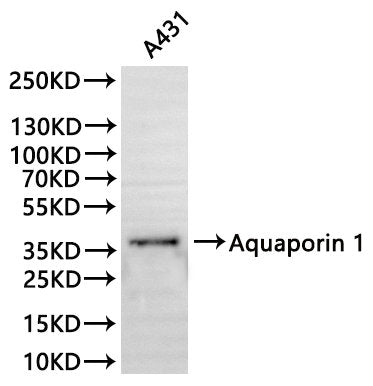 Western Blot
Positive WB detected in: NIH/3T3 whole cell lysate(30µg)
All lanes:Aquaporin 1 antibody at 1:1000
Secondary
Goat polyclonal to rabbit IgG at 1/40000 dilution
Predicted band size: 29 kDa
Observed band size: 40 kDa
Exposure time：2min