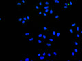 Immunofluorescence staining of HeLa cell with CSB-RA975045A0HU at 1:50 , counter-stained with DAPI. The cells were fixed in 4% formaldehyde, permeabilized using 0.2% Triton X-100 and blocked in 10% normal Goat Serum. The cells were then incubated with the antibody overnight at 4°C. The secondary antibody was Alexa Fluor 488-congugated AffiniPure Goat Anti-Rabbit IgG(H+L).
