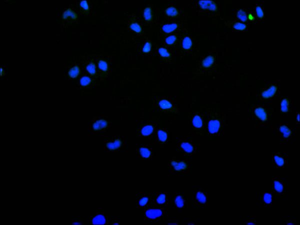 Immunofluorescence staining of HeLa cell with CSB-RA975045A0HU at 1:50 , counter-stained with DAPI. The cells were fixed in 4% formaldehyde, permeabilized using 0.2% Triton X-100 and blocked in 10% normal Goat Serum. The cells were then incubated with the antibody overnight at 4°C. The secondary antibody was Alexa Fluor 488-congugated AffiniPure Goat Anti-Rabbit IgG(H+L).