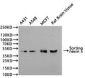 Western Blot
Positive WB detected in: A431 whole cell lysate(30µg), A549 whole cell lysate(30µg), MCF-7 whole cell lysate(30µg), Rat brain tissue lysate(30µg)
All lanes: Sorting nexin 5 antibody at 1:1000
Secondary
Goat polyclonal to rabbit IgG at 1/40000 dilution
Predicted band size: 47 kDa
Observed band size: 47 kDa
Exposure time：3min