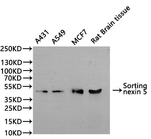 Western Blot
Positive WB detected in: A431 whole cell lysate(30µg), A549 whole cell lysate(30µg), MCF-7 whole cell lysate(30µg), Rat brain tissue lysate(30µg)
All lanes: Sorting nexin 5 antibody at 1:1000
Secondary
Goat polyclonal to rabbit IgG at 1/40000 dilution
Predicted band size: 47 kDa
Observed band size: 47 kDa
Exposure time：3min