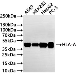 Western Blot
Positive WB detected in: A549 whole cell lysate(30µg) , HEK293 whole cell lysate(30µg) , HepG2 whole cell lysate(30µg) , PC-3 whole cell lysate(30µg) 
All lanes: HLA-A antibody at 1:1000
Secondary
Goat polyclonal to rabbit IgG at 1/50000 dilution
Predicted band size: 41 kDa
Observed band size: 41 kDa
Exposure time: 2min