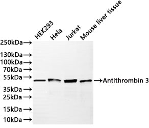 Western Blot
Positive WB detected in:HEK293 whole cell lysate(30µg) , Hela whole cell lysate(30µg) , Jurkat whole cell lysate(30µg) , Mouse liver tissue lysate(30µg) 
All lanes:Antithrombin 3 antibody at 1:1000
Secondary
Goat polyclonal to rabbit IgG at 1/40000 dilution<br /
Predicted band size: 47 kDa 
Observed band size: 47 kDa
Exposure time：1min