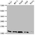 Western Blot
Positive WB detected in: Hela whole cell lysate, MCF-7 whole cell lysate, HepG2 whole cell lysate, A549 whole cell lysate, Rat brain tissue
All lanes: TXN antibody at 1:2000
Secondary
Goat polyclonal to rabbit IgG at 1/50000 dilution
Predicted band size: 10, 12 kDa
Observed band size: 12 kDa