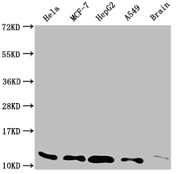 Western Blot
Positive WB detected in: Hela whole cell lysate, MCF-7 whole cell lysate, HepG2 whole cell lysate, A549 whole cell lysate, Rat brain tissue
All lanes: TXN antibody at 1:2000
Secondary
Goat polyclonal to rabbit IgG at 1/50000 dilution
Predicted band size: 10, 12 kDa
Observed band size: 12 kDa