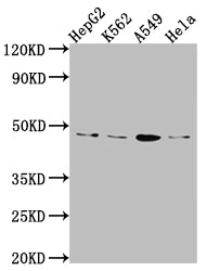 Western Blot
Positive WB detected in: HepG2 whole cell lysate, K562 whole cell lysate, A549 whole cell lysate, Hela whole cell lysate
All lanes: CD274 Antibody at 1:1000
Secondary
Goat polyclonal to rabbit IgG at 1/50000 dilution
Predicted band size: 34, 21, 21 kDa
Observed band size: 45 kDa