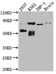 Western Blot
Positive WB detected in: 293T whole cell lysate, K562 whole cell lysate, THP-1 whole cell lysate, Mouse Brain whole cell lysate
All lanes: PKC antibody at 1:1000
Secondary
Goat polyclonal to rabbit IgG at 1/50000 dilution
Predicted band size: 82, 75, 68 kDa
Observed band size: 82, 55 kDa