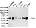 Western Blot
Positive WB detected in: U-251MG whole cell lysate(20µg) ,A549 whole cell lysate(20µg) , COLO-205 whole cell lysate(20µg) , Hela whole cell lysate(20µg) ,K562 whole cell lysate(20µg) ,SP2/0 whole cell lysate(20µg) 
All lanes: TCEA1 antibody at 1:1000
Secondary
Goat polyclonal to rabbit IgG at 1/40000 dilution
Predicted band size: 34 kDa
Observed band size: 37 kDa
Exposure time：2min