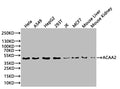 Western Blot Positive WB detected in: Hela whole cell lysate(20µg) , A549 whole cell lysate(20µg) , HepG2 whole cell lysate(20µg) , 293T whole cell lysate(20µg) , MCF7 whole cell lysate(20µg) , JK whole cell lysate(20µg) , Mouse Liver tissue lysate(20µg) , Mouse Kidney tissue lysate(20µg)  All lanes: ACAA2 antibody at 1:1000 Secondary Goat polyclonal to rabbit IgG at 1/50000 dilution Predicted band size: 42 kDa Observed band size: 42 kDa Exposure time: 10s