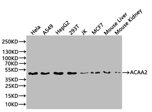 Western Blot Positive WB detected in: Hela whole cell lysate(20µg) , A549 whole cell lysate(20µg) , HepG2 whole cell lysate(20µg) , 293T whole cell lysate(20µg) , MCF7 whole cell lysate(20µg) , JK whole cell lysate(20µg) , Mouse Liver tissue lysate(20µg) , Mouse Kidney tissue lysate(20µg)  All lanes: ACAA2 antibody at 1:1000 Secondary Goat polyclonal to rabbit IgG at 1/50000 dilution Predicted band size: 42 kDa Observed band size: 42 kDa Exposure time: 10s