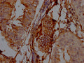 NT5E Antibody – Figure 1 of 2