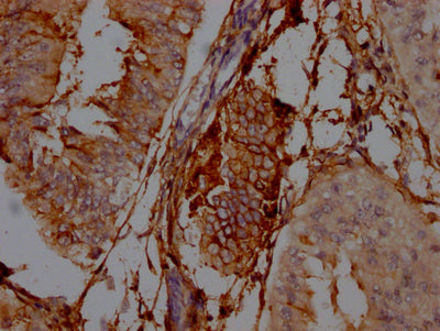 NT5E Antibody – Figure 1 of 2