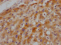 GHR Antibody – Figure 1 of 3